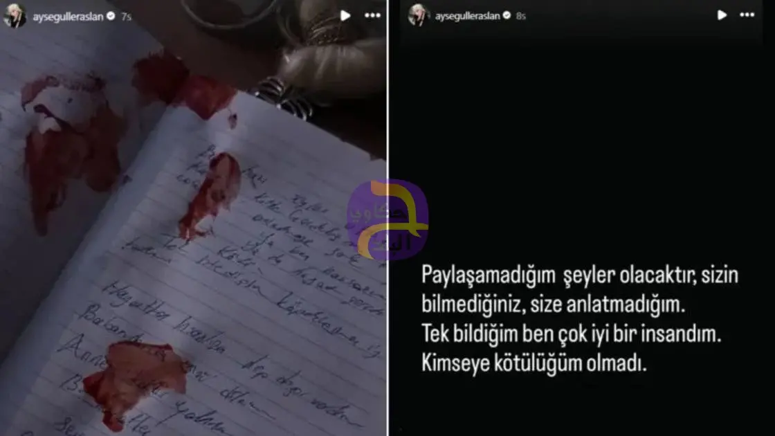 رسالة مكتوبة بالدم.. غموض يلف وفاة مؤثرة تركية والقاتل قد يكون فناناً