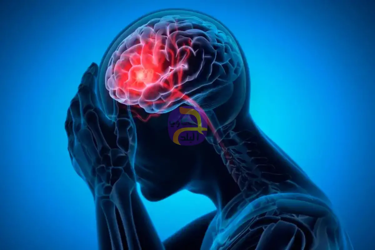 لإنقاذ المرضى لحظياً.. مصر تواجه السكتات الدماغية بالـAI