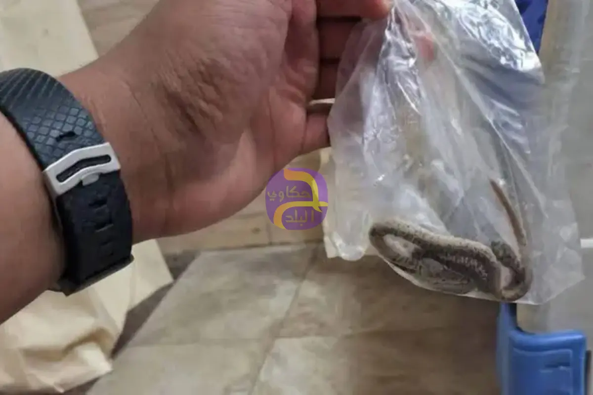 لدغه ثعبان فأحضره معه إلى المستشفى.. واقعة غريبة في صعيد مصر